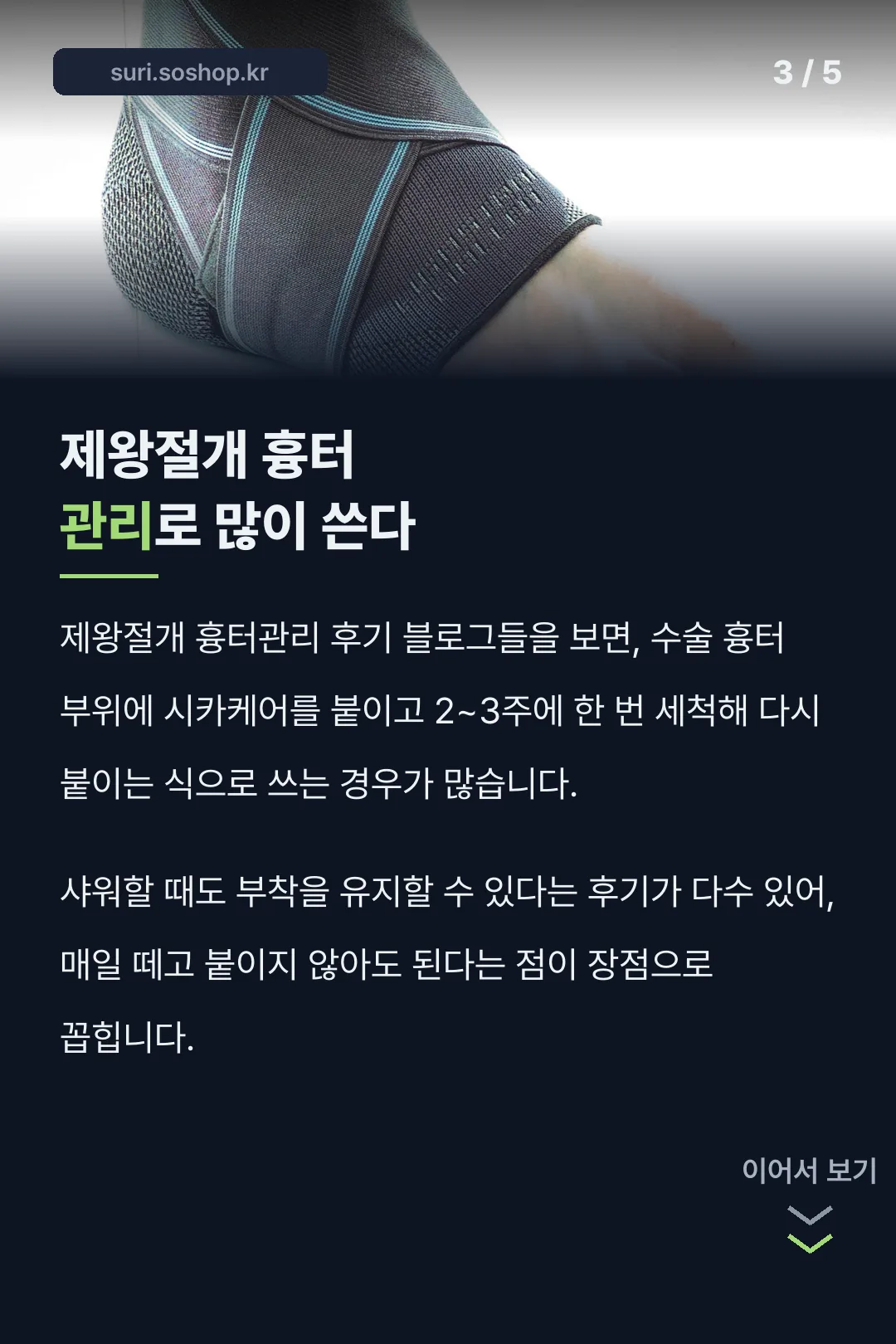 제왕절개 흉터관리 활용