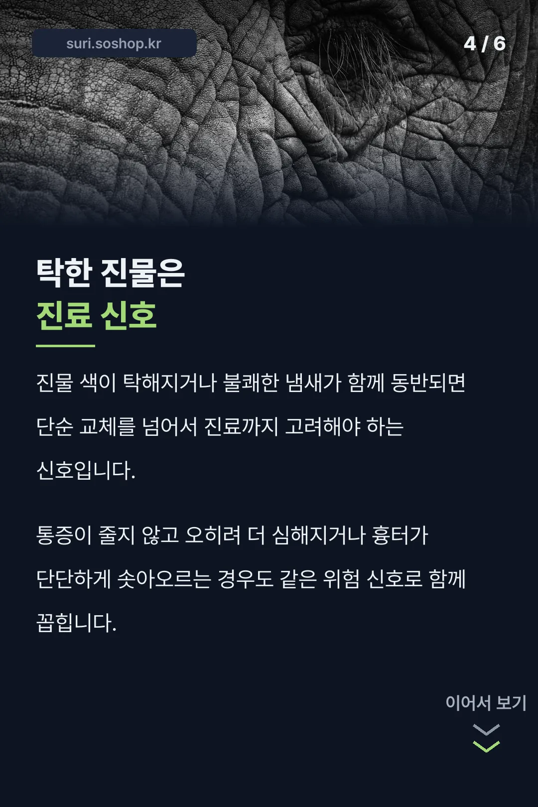 탁한 진물 진료 신호