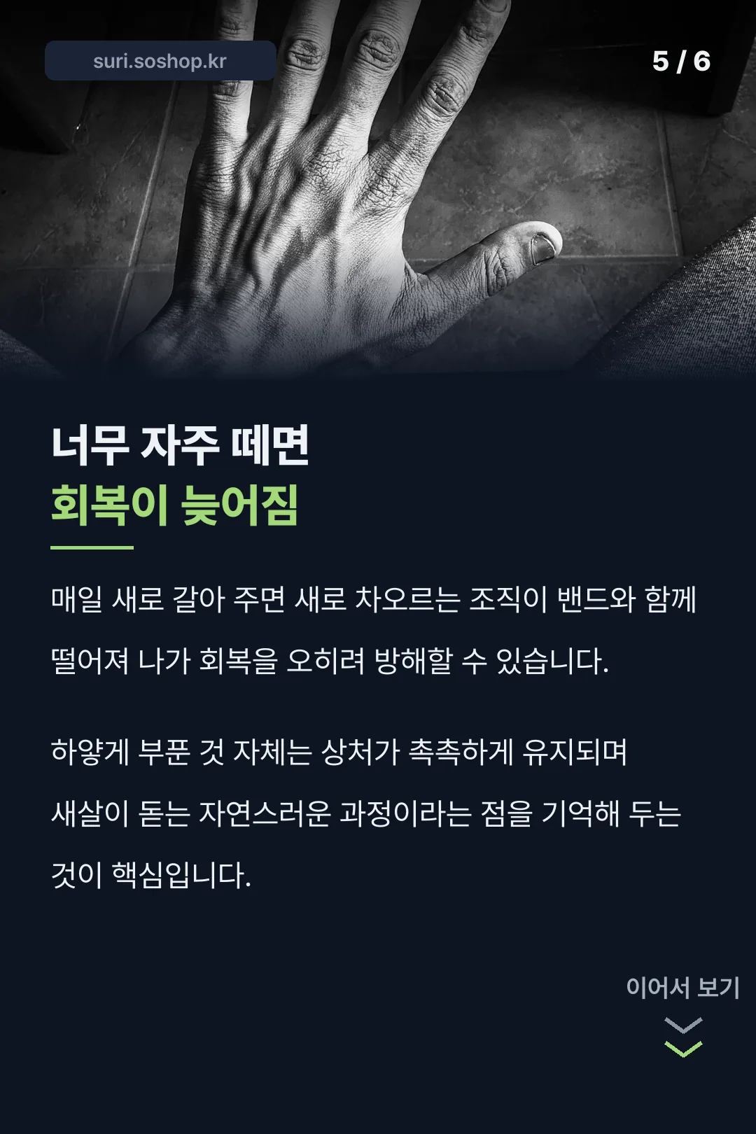 너무 자주 떼면 역효과